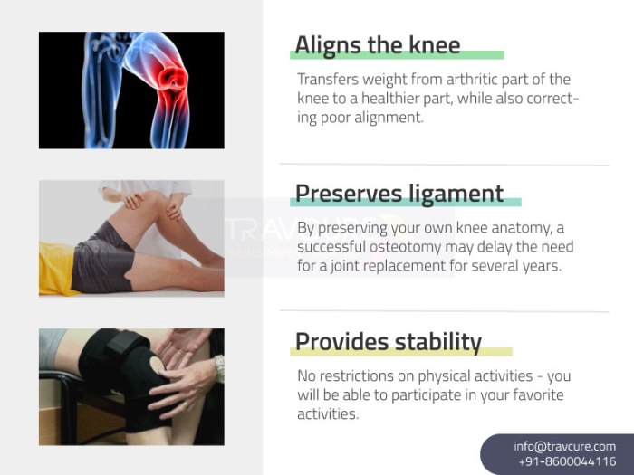 knee-osteotomy-benefits