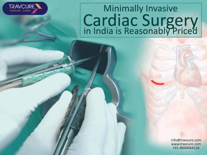 Minimally Invasive Cardiac Surgery in India is Reasonably Priced